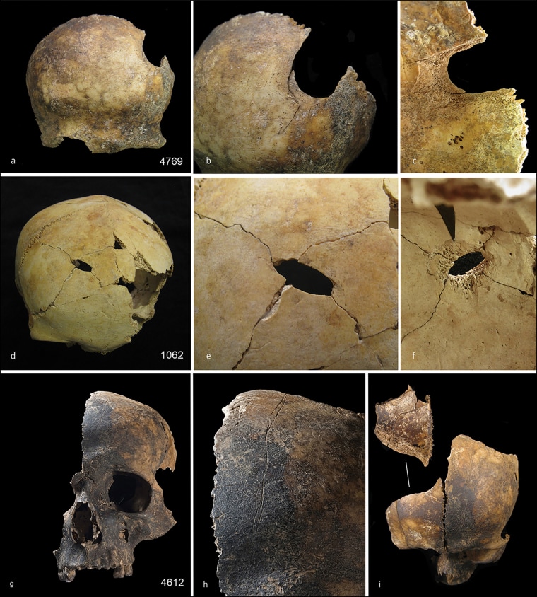 Early signs of cannibalism from bone samples